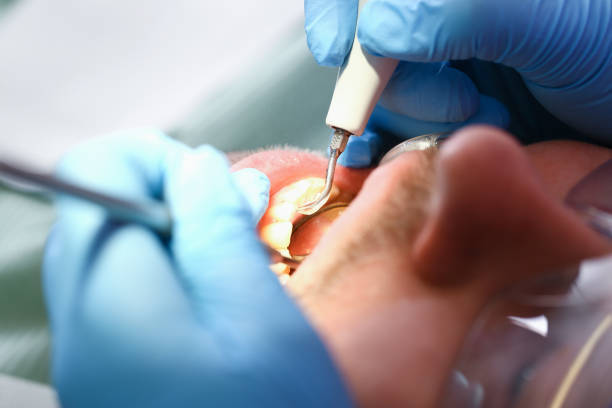 Best Root Canal Emergency Dentist  in Lake Vla, IL